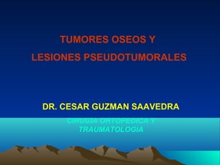 TUMORES OSEOS Y
LESIONES PSEUDOTUMORALES
DR. CESAR GUZMAN SAAVEDRA
CIRUGIA ORTOPEDICA Y
TRAUMATOLOGIA
 