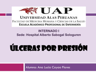 INTERNADO I
 Sede: Hospital Alberto Sabogal Sologuren



ÚLCERAS POR PRESIÓN

      Alumna: Ana Lucía Cayao Flores
 