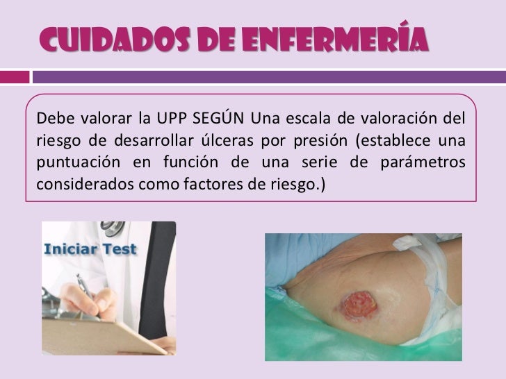 ULCERAS POR PRESION