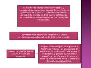 El estudio radiológico simple latero-lateral y
ventrodorsal para determinar tamaño, forma, contorno
y ubicación de la próstata. El tamaño considerado
normal de la próstata no debe superar el 50% de la
anchura de la entrada de la pelvis en una radiografía
ventrodorsal.
La próstata debe encontrarse rodeando a la uretra
pelviana, comenzando en el cuello de la vejiga urinaria
evaluación citológica de la
tercera fracción del
eyaculado
Un gran número de glóbulos rojos indica
hemorragia reciente, un gran número de
leucocitos indica inflamación y la presencia
de bacterias y glóbulos blancos indica
infección activa. Presencia de sangre a
modo de posos de café indica la presencia
de una hemorragia crónica.
 
