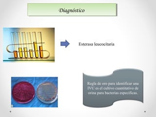 DiagnósticoDiagnóstico
Esterasa leucocitaria
Regla de oro para identificar una
IVU es el cultivo cuantitativo de
orina para bacterias especificas.
 