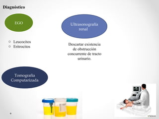 EGO
o Leucocitos
o Eritrocitos
Tomografía
Computarizada
Ultrasonografía
renal
Diagnóstico
Descartar existencia
de obstrucción
concurrente de tracto
urinario.
 