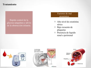 Tratamiento
Rápido control de la
glucosa sanguínea y alivio
de la obstrucción urinaria.
Factores de mal
pronóstico
o Alto nivel de creatinina
sérica
o Bajo recuento de
plaquetas
o Presencia de liquido
renal o perirrenal
 