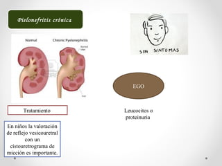 Pielonefritis crónica
EGO
Leucocitos o
proteinuria
Tratamiento
En niños la valoración
de reflejo vesicouretral
con un
cistouretrograma de
micción es importante.
 
