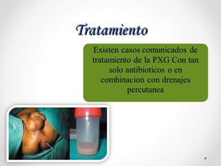 TratamientoTratamiento
 