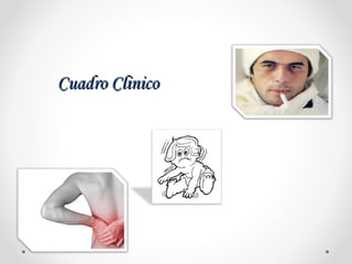 Cuadro ClinicoCuadro Clinico
 