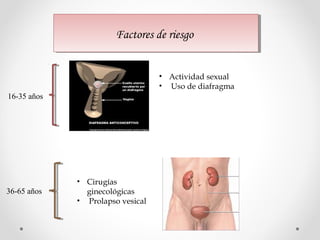 Factores de riesgoFactores de riesgo
16-35 años
36-65 años
• Actividad sexual
• Uso de diafragma
• Cirugías
ginecológicas
• Prolapso vesical
 