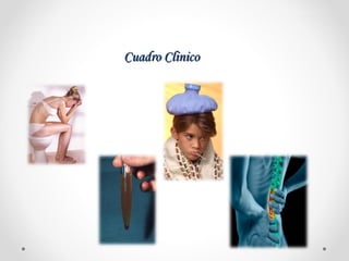 Cuadro ClinicoCuadro Clinico
 