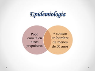 EpidemiologiaEpidemiologia
 