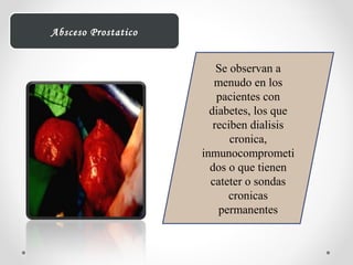 Se observan a
menudo en los
pacientes con
diabetes, los que
reciben dialisis
cronica,
inmunocomprometi
dos o que tienen
cateter o sondas
cronicas
permanentes
Absceso Prostatico
 