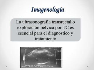 ImagenologiaImagenologia
La ultrasonografía transrectal o
exploración pélvica por TC es
esencial para el diagnostico y
tratamiento
 