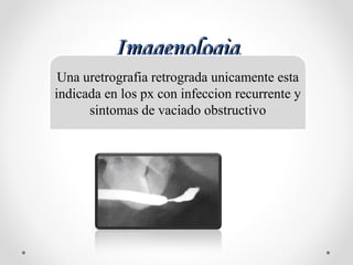 ImagenologiaImagenologia
Una uretrografia retrograda unicamente esta
indicada en los px con infeccion recurrente y
sintomas de vaciado obstructivo
 