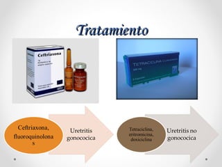 TratamientoTratamiento
 