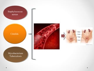 Staphylococcus
aureus
Staphylococcus
aureus
Cándida
Mycobacterium
Tuberculosis
Mycobacterium
Tuberculosis
 
