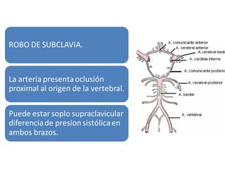 ROBO DE SUBCLAVIA.

La arteria presenta oclusión
proximal al origen de la vertebral.
Puede estar soplo supraclavicular
diferencia de presion sistólica en
ambos brazos.

 