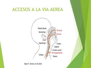 ACCESOS A LA VIA AEREA
 