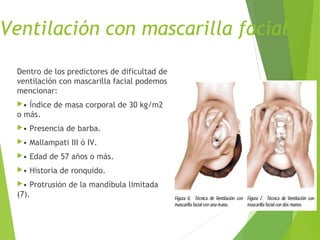 Ventilación con mascarilla facial
Dentro de los predictores de dificultad de
ventilación con mascarilla facial podemos
mencionar:
• Índice de masa corporal de 30 kg/m2
o más.
• Presencia de barba.
• Mallampati III ó IV.
• Edad de 57 años o más.
• Historia de ronquido.
• Protrusión de la mandíbula limitada
(7).
 