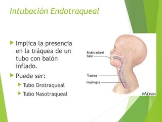 Intubación Endotraqueal
 Implica la presencia
en la tráquea de un
tubo con balón
inflado.
 Puede ser:
 Tubo Orotraqueal
 Tubo Nasotraqueal
 