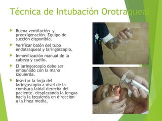 Técnica de Intubación Orotraqueal
 Buena ventilación y
preoxigenación. Equipo de
succión disponible.
 Verificar balón del tubo
endotraqueal y laringoscopio.
 Inmovilización manual de la
cabeza y cuello.
 El laringoscopio debe ser
empuñado con la mano
izquierda.
 Insertar la hoja del
laringoscopio a nivel de la
comisura labial derecha del
paciente, desplazando la lengua
hacia la izquierda en dirección
a la línea media.
 