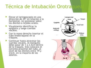 Técnica de Intubación Orotraqueal
 Elevar el laringoscopio en una
dirección de 45º en relación a la
horizontal, sin presionar sobre
los dientes o tejidos orales.
 Visualmente identificar la
epiglotis y luego cuerdas
vocales.
 Con la mano derecha insertar el
tubo endotraqueal en la
tráquea.
 Continuar hasta atravesar las
cuerdas vocales, el manguito
debe pasar de 1 a 2,5cm dentro
de la traquea. Esto colocara el
extremo proximal del tubo, al
nivel de los dientes entre 19 y
23cm, en la mayoría de los
adultos.
 