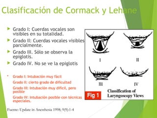Clasificación de Cormack y Lehane
 Grado I: Cuerdas vocales son
visibles en su totalidad.
 Grado II: Cuerdas vocales visibles
parcialmente.
 Grado III. Sólo se observa la
epiglotis.
 Grado IV. No se ve la epiglotis
* Grado I: Intubación muy fácil
Grado II: cierto grado de dificultad
Grado III: Intubación muy difícil, pero
posible
Grado IV: Intubación posible con técnicas
especiales.
Fuente: Update in Anesthesia 1998; 9(9):1-4
 