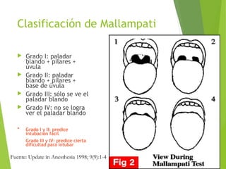 Clasificación de Mallampati
 Grado I: paladar
blando + pilares +
úvula
 Grado II: paladar
blando + pilares +
base de úvula
 Grado III: sólo se ve el
paladar blando
 Grado IV: no se logra
ver el paladar blando
* Grado I y II: predice
intubación fácil
Grado III y IV: predice cierta
dificultad para intubar
Fuente: Update in Anesthesia 1998; 9(9):1-4
 