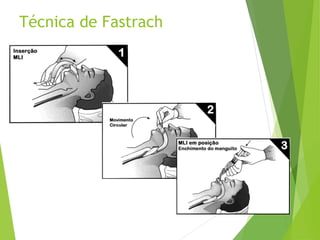Técnica de Fastrach
 