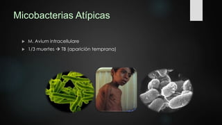 Micobacterias Atípicas
 M. Avium intracellulare
 1/3 muertes  TB (aparición temprana)
 