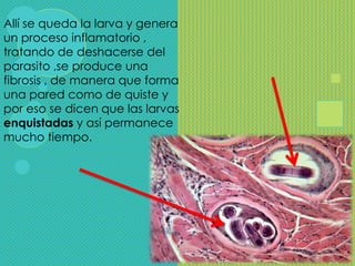 Allí se queda la larva y genera
un proceso inflamatorio ,
tratando de deshacerse del
parasito ,se produce una
fibrosis , de manera que forma
una pared como de quiste y
por eso se dicen que las larvas
enquistadas y así permanece
mucho tiempo.
 
