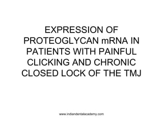 EXPRESSION OF
PROTEOGLYCAN mRNA IN
PATIENTS WITH PAINFUL
CLICKING AND CHRONIC
CLOSED LOCK OF THE TMJ

www.indiandentalacademy.com

 