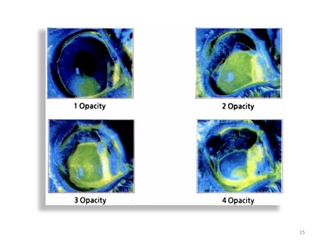 Expt 11 Determination Of Acute Eye Irritation Corrosion Of A Test Substance