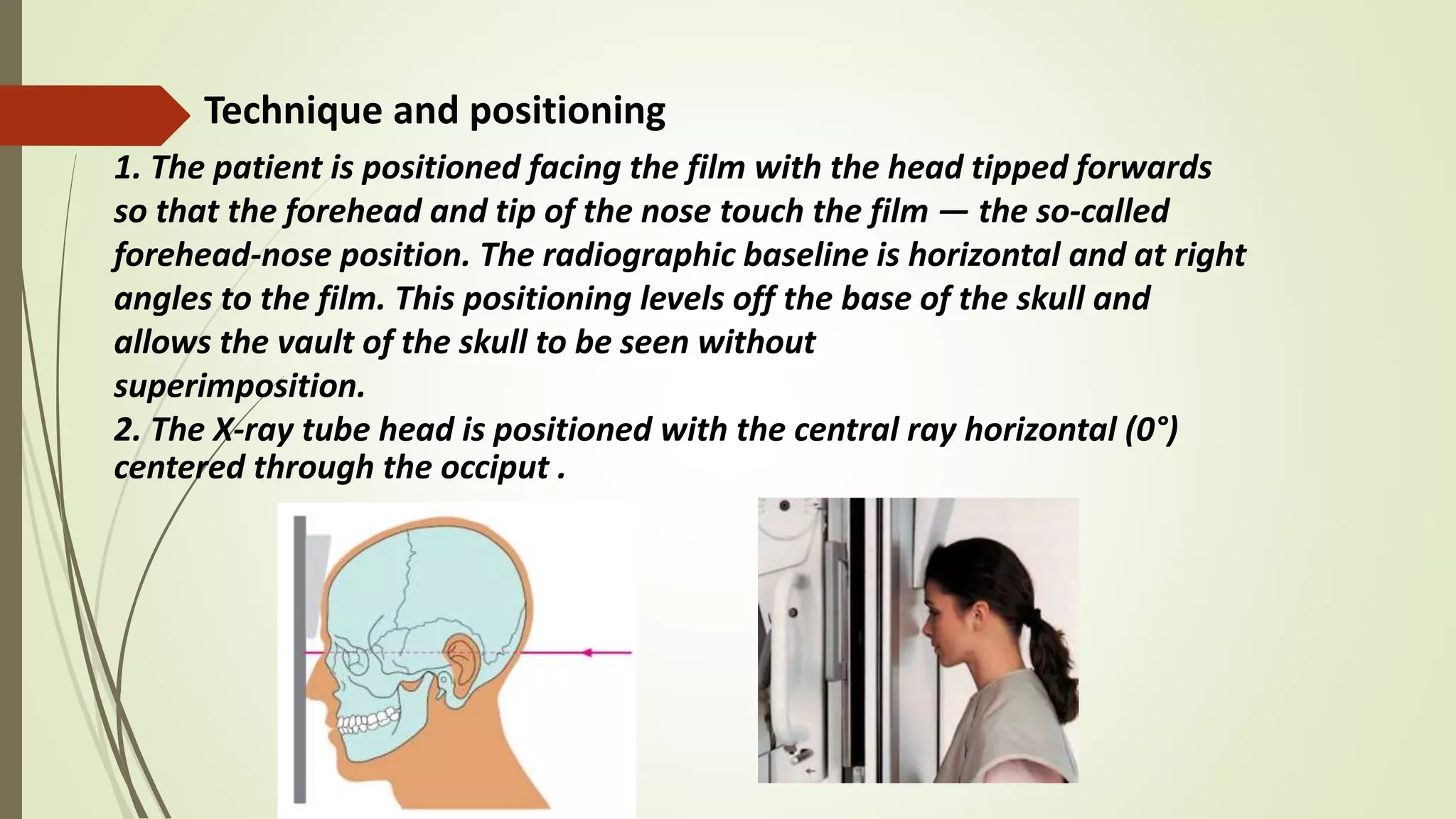 Exraoral and intraoral radiography | PPTX