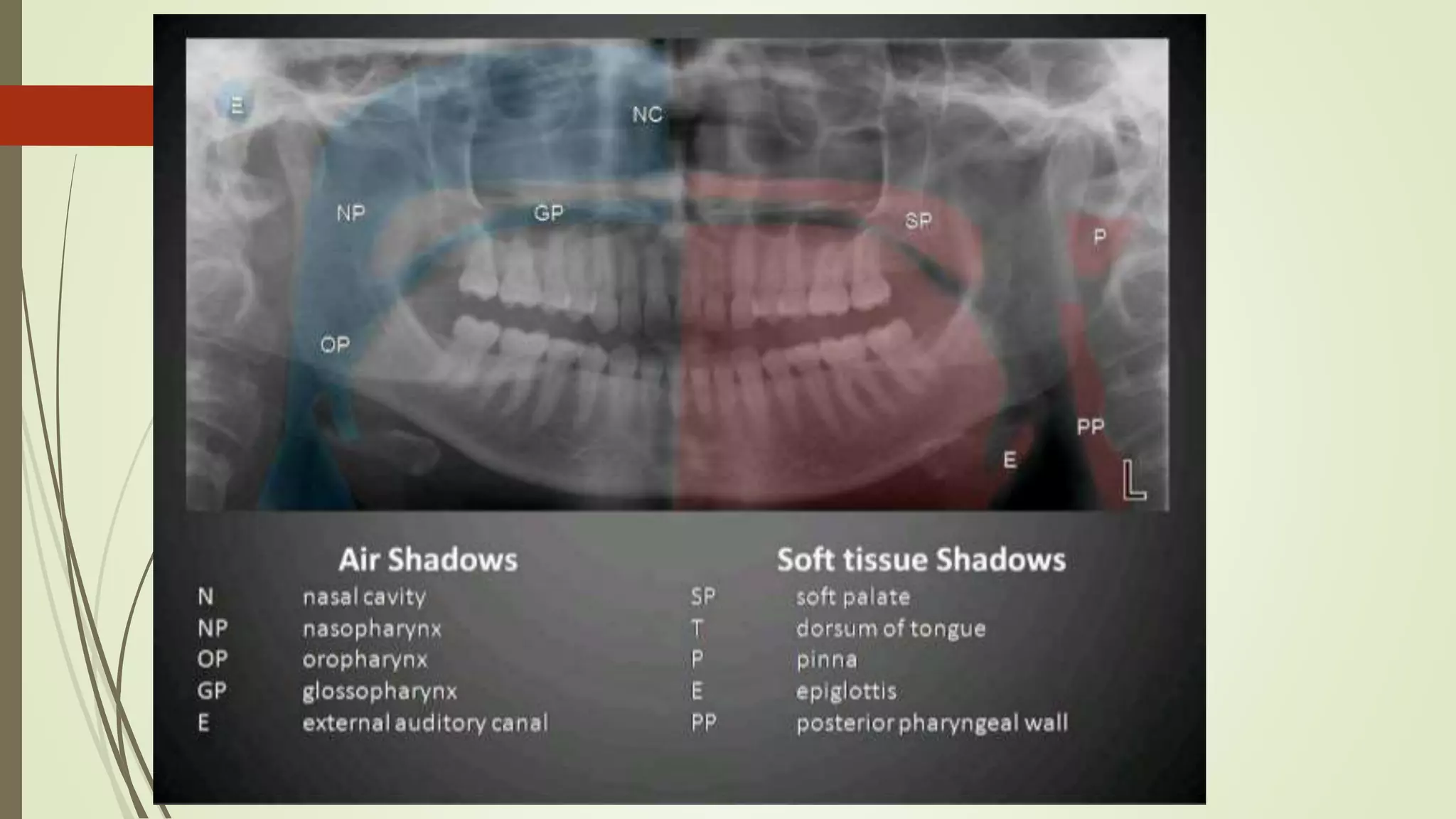 Exraoral and intraoral radiography | PPTX