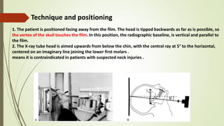 Vertical Radiograph Exraoral and intraoral radiography | PPTX