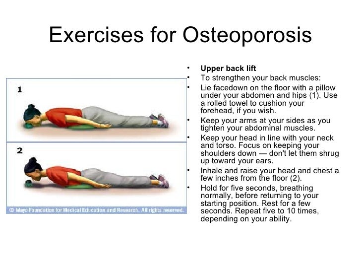 Preventing Osteoporosis by doing Exercises