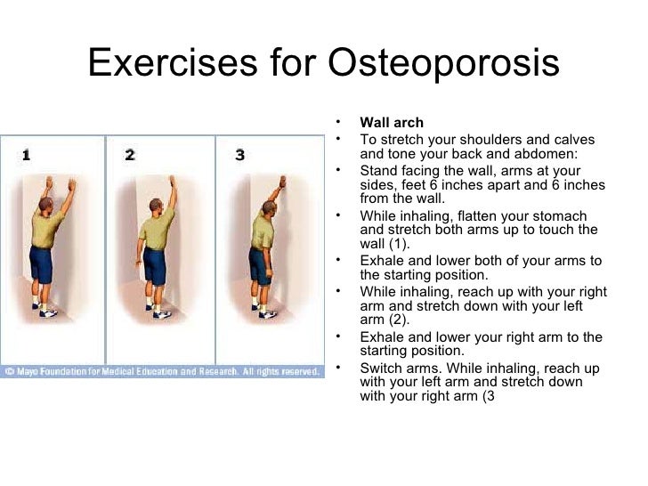 Preventing Osteoporosis by doing Exercises