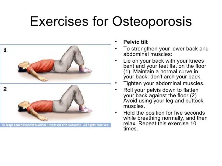 Preventing Osteoporosis by doing Exercises