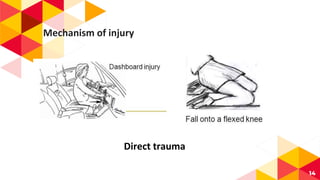 14
Mechanism of injury
Direct trauma
 