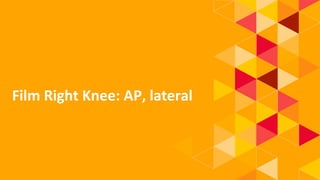 1.
Film Right Knee: AP, lateral
 