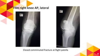 Film right knee AP, lateral
Closed comminuted fracture at Right patella
9
 