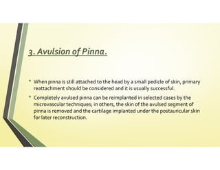 External ear abnormalities