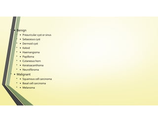 External ear abnormalities