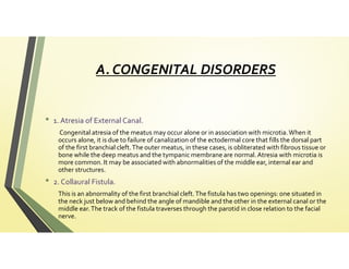 External ear abnormalities