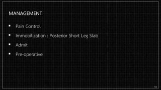 MANAGEMENT
▪ Pain Control
▪ Immobilization : Posterior Short Leg Slab
▪ Admit
▪ Pre-operative
14
 