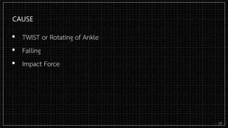 CAUSE
▪ TWIST or Rotating of Ankle
▪ Falling
▪ Impact Force
17
 
