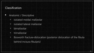 Classification
▪ Anatomic / Descriptive
▫ isolated medial malleolar
▫ isolated lateral malleolar
▫ bimalleolar
▫ trimalleolar
▫ Bosworth fracture-dislocation (posterior dislocation of the fibula
behind incisura fibularis)
25
 