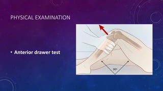 ACL INJURY | PPTX