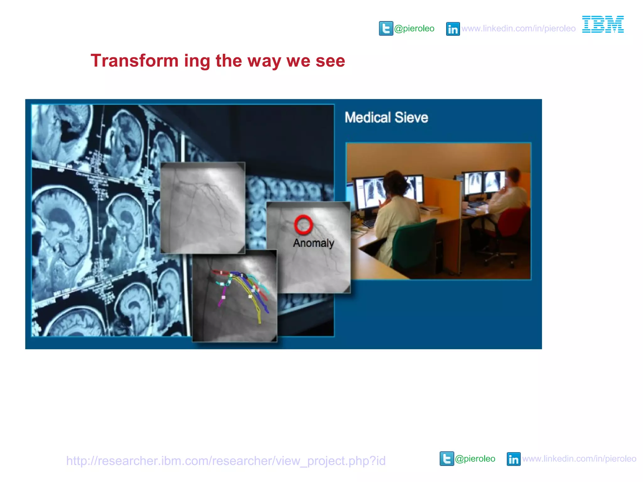 @pieroleo www.linkedin.com/in/pieroleo
@pieroleo www.linkedin.com/in/pieroleo
Transform ing the way we see
Medical Sieve – smart decision support system
for radiologists. Performs visual anomaly
identification and diagnostic analysis on X-rays,
MRIs, PET and CAT scans, sonograms, and
echo-cardiograms
(http://researcher.ibm.com/researcher/view_project.php?id=4384)
 
