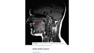 IMAGING IN ORAL CANCER | PPTX
