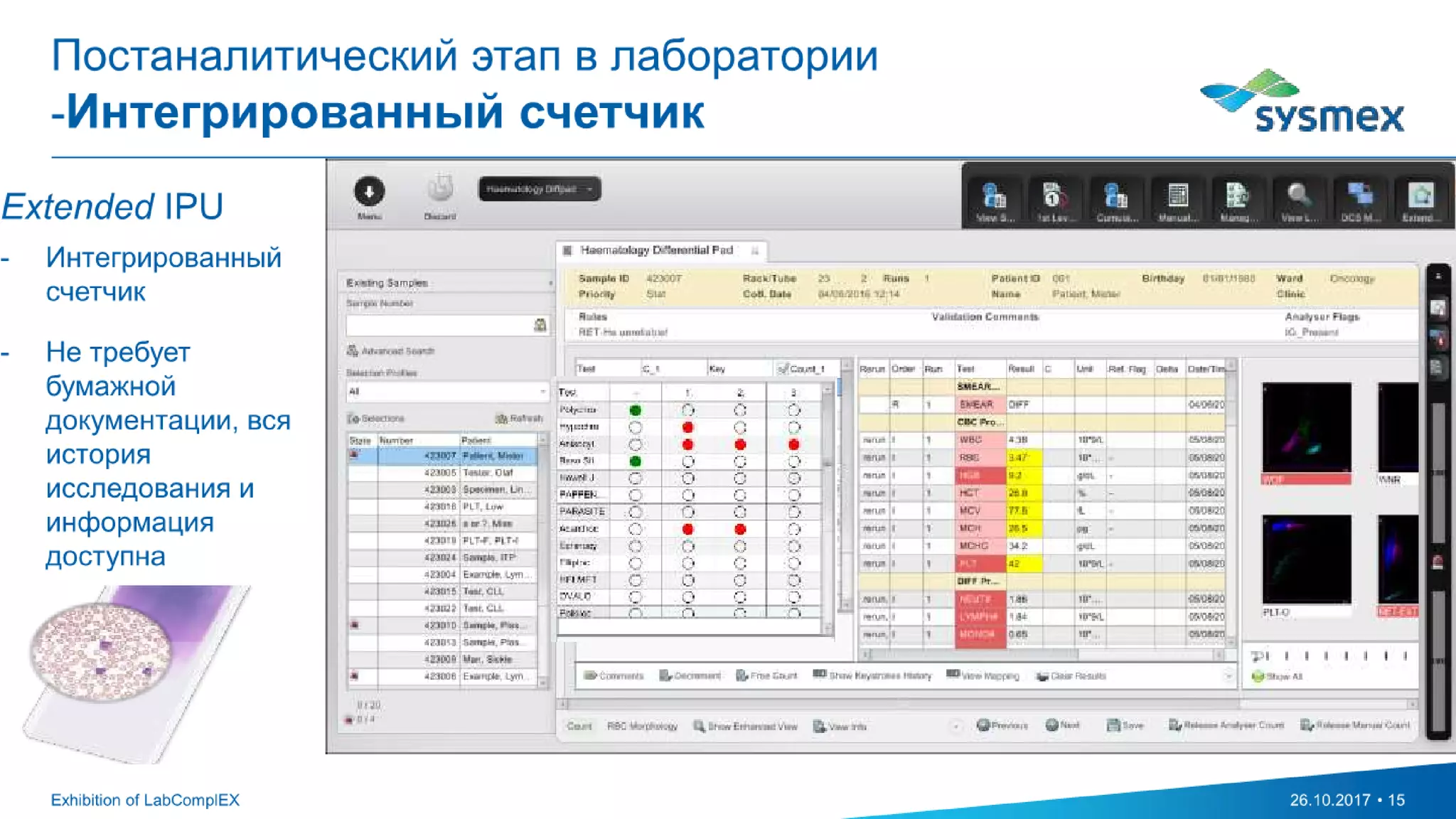 Extended IPU - the intelligence behind